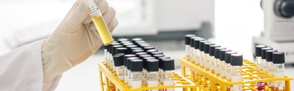 Testing of Biological Indicators (BIs)