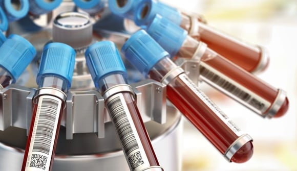 Reagenzgläser gefüllt mit Blut